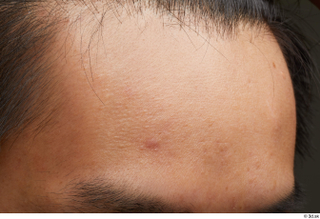 HD Face Skin Lan face forehead hair skin pores skin…